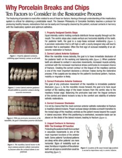 Why Porcelain Breaks and Chips